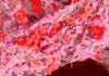 La thérapie génique de l’hémophilie de 3,5 millions de dollars est le médicament le plus cher au monde