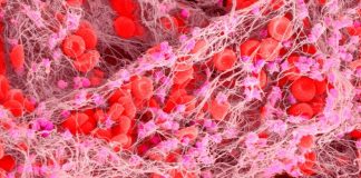 La thérapie génique de l’hémophilie de 3,5 millions de dollars est le médicament le plus cher au monde