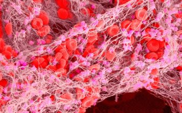 La thérapie génique de l’hémophilie de 3,5 millions de dollars est le médicament le plus cher au monde