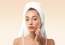 Les 10 meilleures facons d’eliminer l’acne