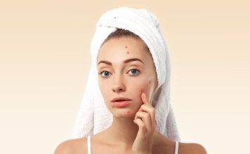 Les 10 meilleures facons d’eliminer l’acne
